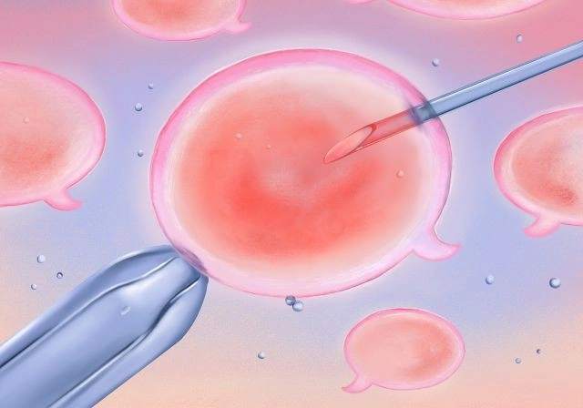 عيادة-حقن-مجهري-نسا-توليد