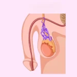 دوالي-الخصية